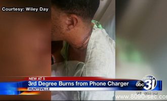 iPhone充电器漏电 导致阿拉巴马一男子不幸被三度烧伤